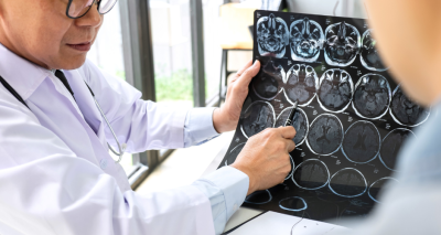 How to get a fast MRI in Ontario
