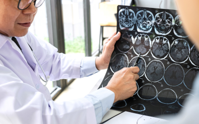 How to Get an MRI or CT Scan Fast in Ontario